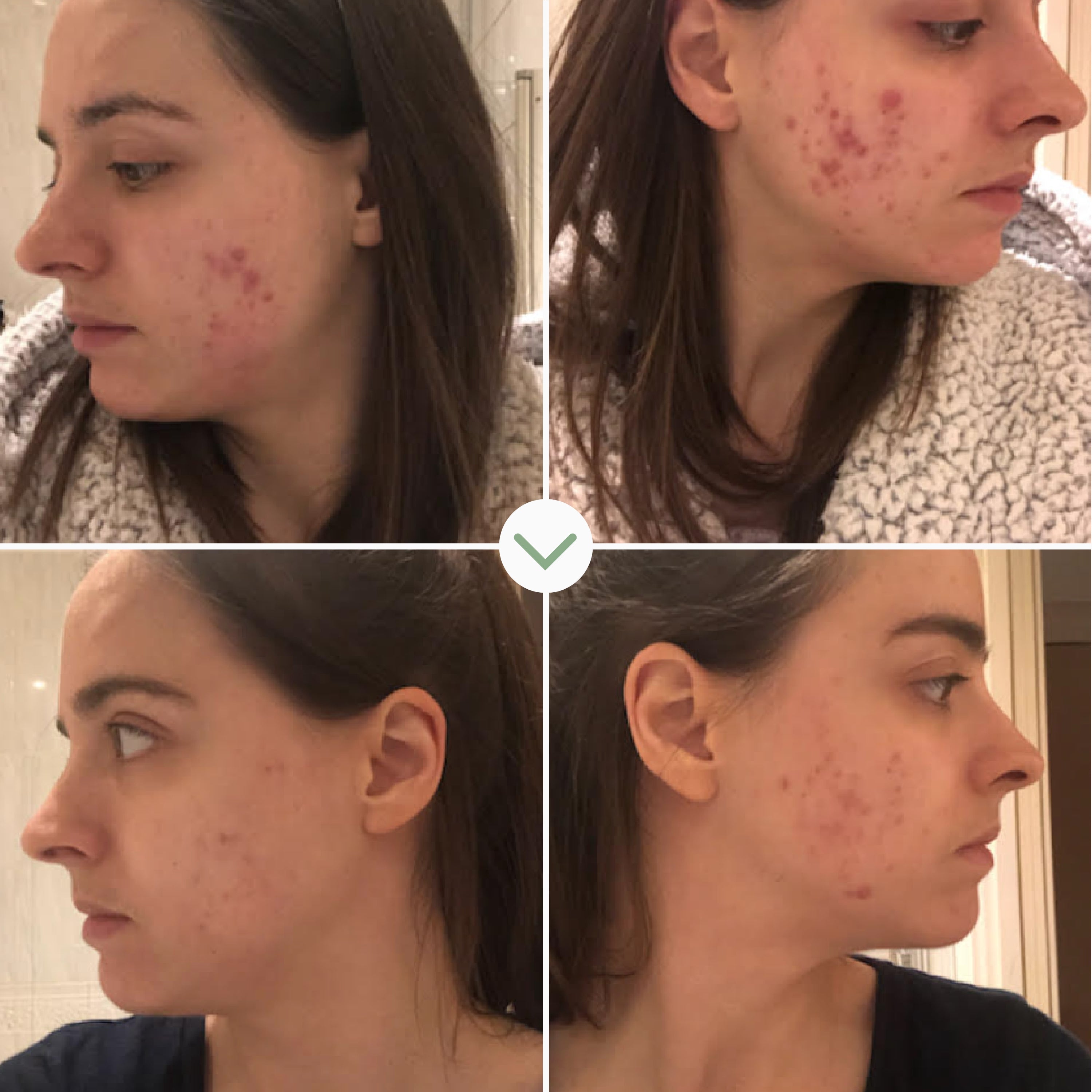Instant Kalmer Ceramide Serum