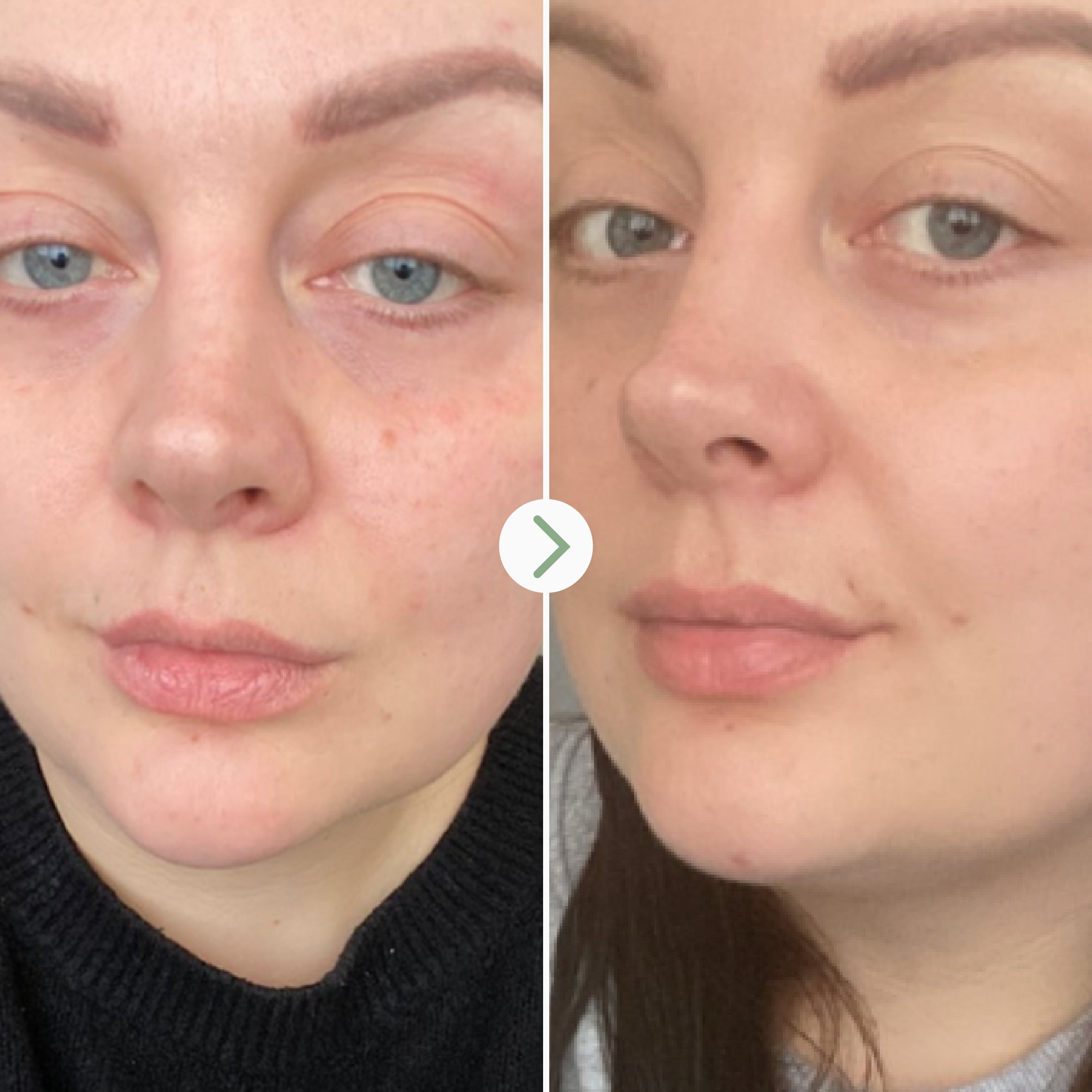 Rosehip Bioregenerate Face Oil