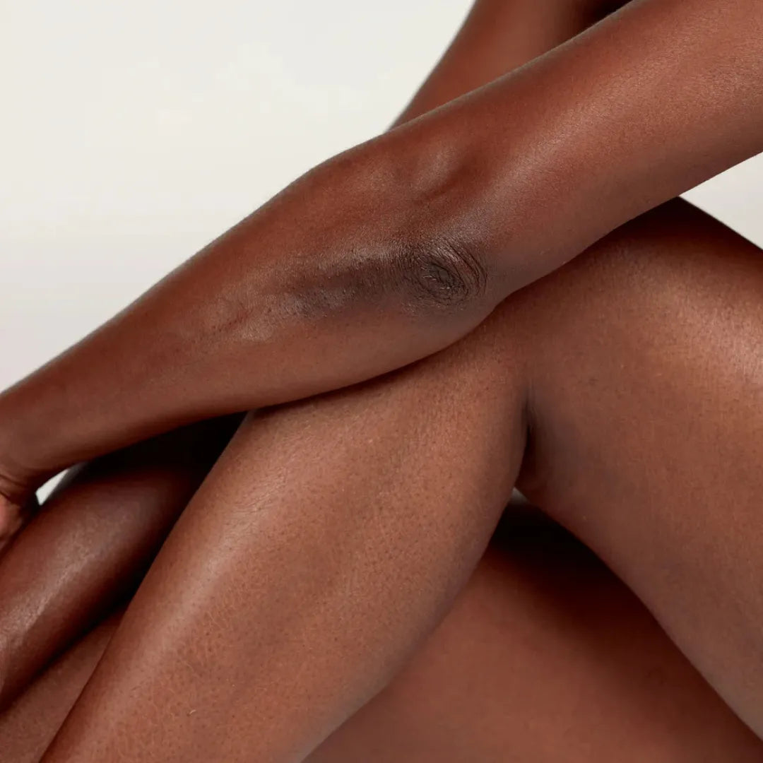 The Gemini - Stretch Mark Dual System