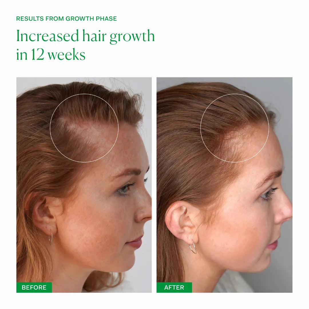 Growth Phase