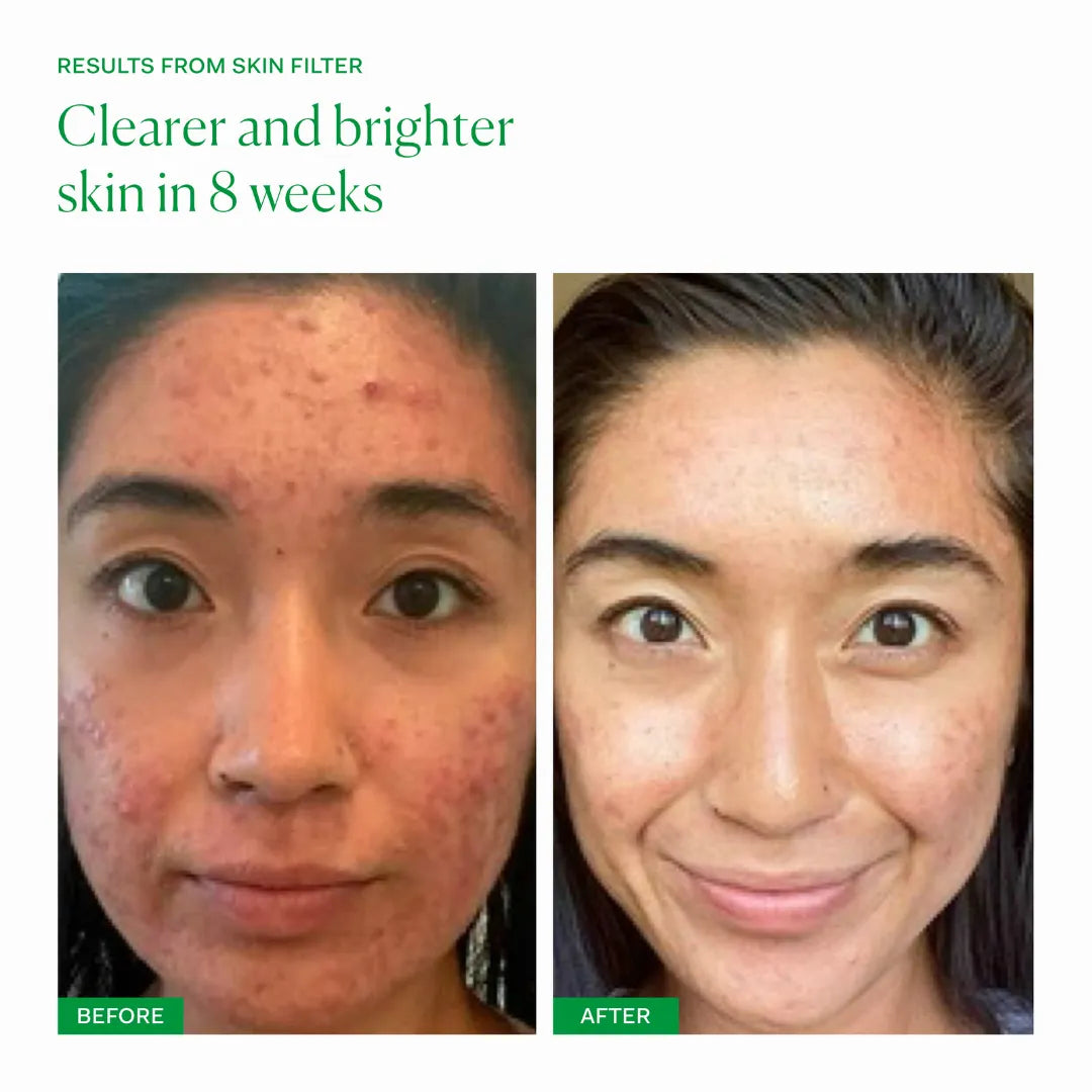 Skin Filter